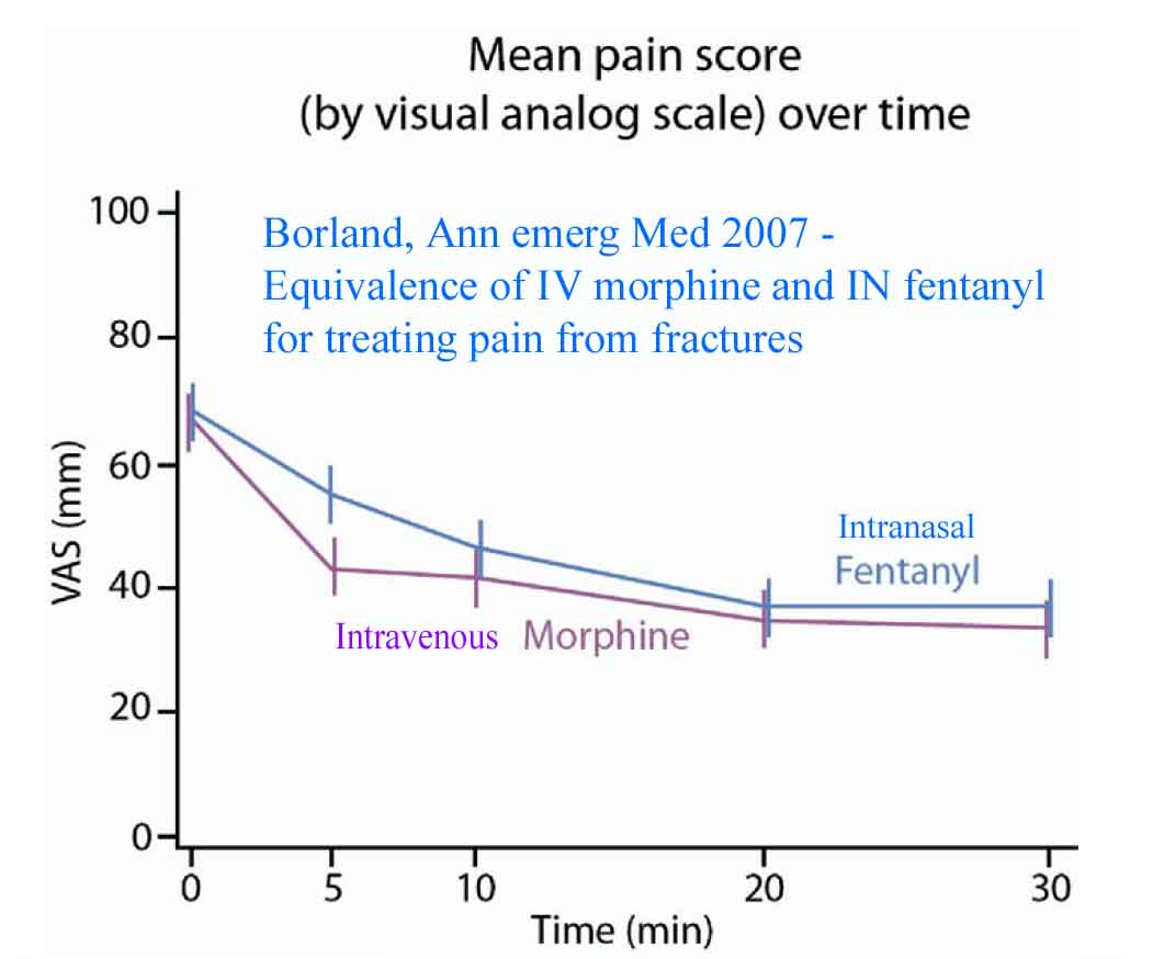Graph demonstrating equivelent pain control with nasal fentanyl versus IV morphine in children with extremity fractures