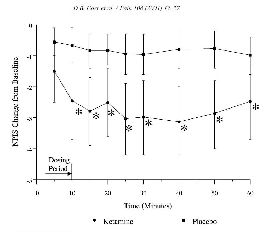 pain intensity score reductions following intranasal ketamine for breakthrough pain