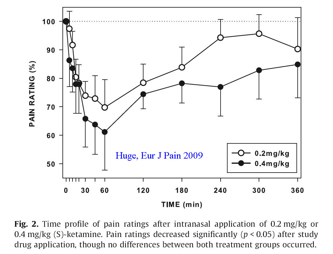 Intranasal low dose ketamine to control neuropathic pain